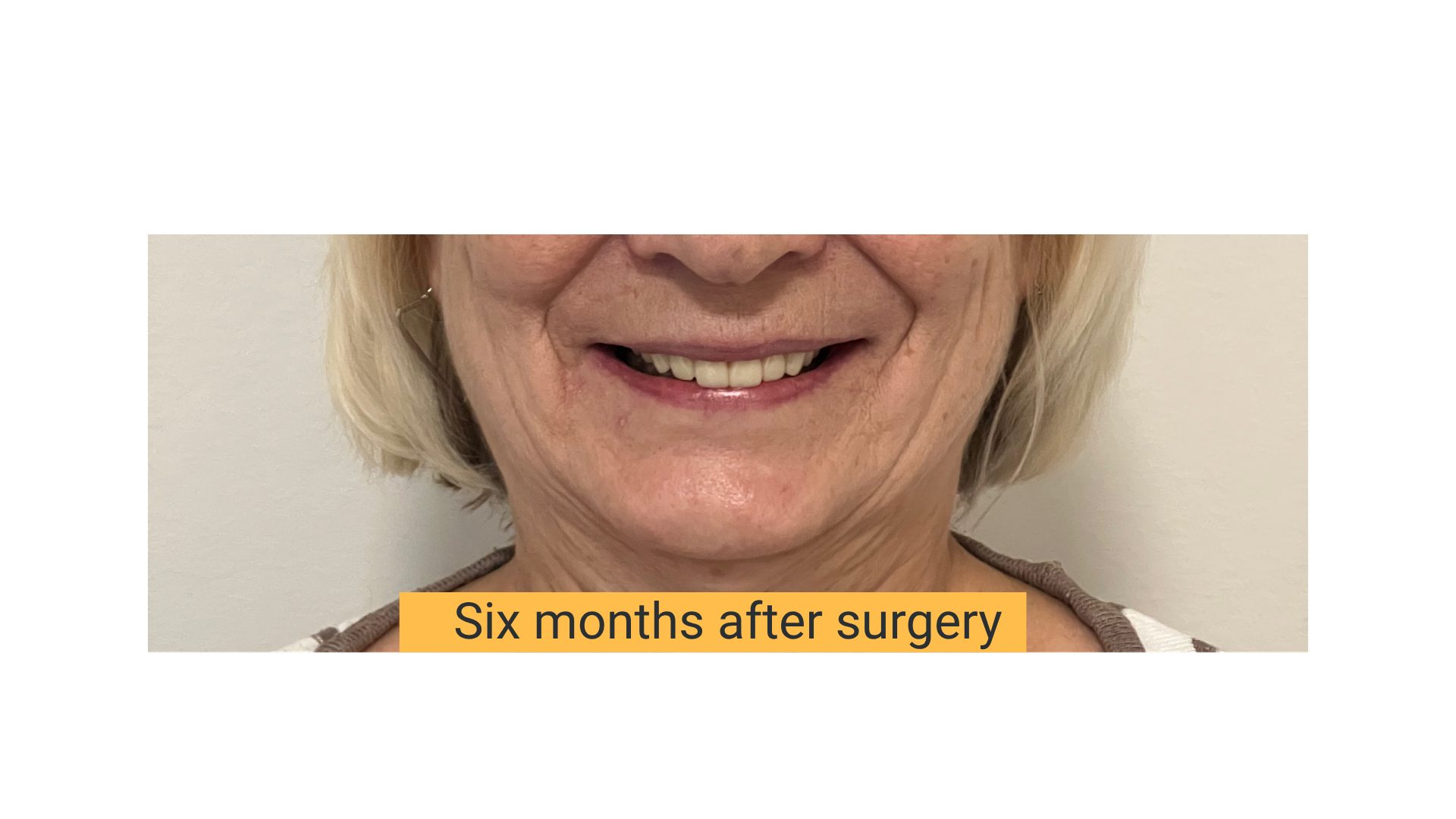 你的段落文字 (2)-2