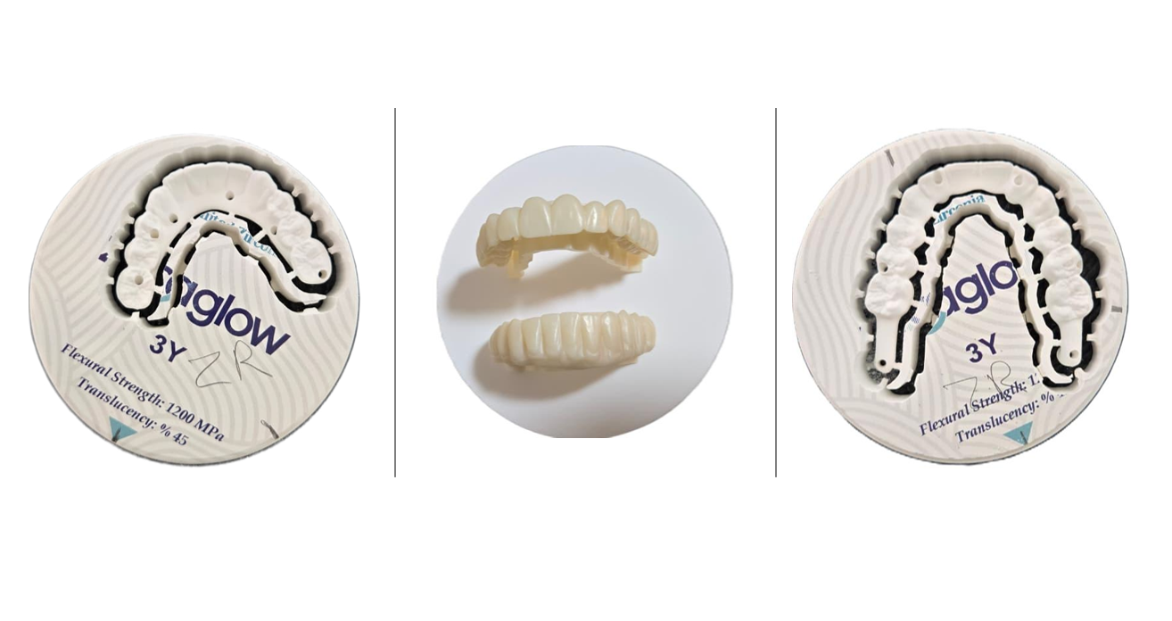3Y‑TZP Zircaglow 3Y ZR zirconia blanks and milled full‑arch prosthesis workpieces processed by 5‑axis CAD/CAM milling machine