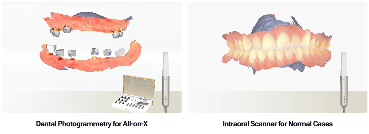 intraoral photogrammetry