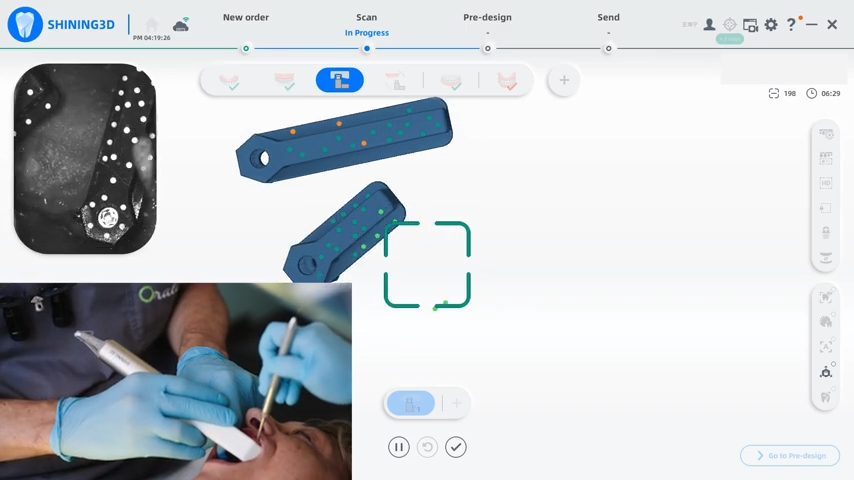Intraoral Photogrammetry