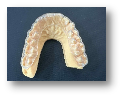 conventional splint 2