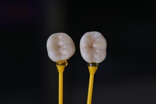 Sintering – Enamelling – Adjustment&nbsp;