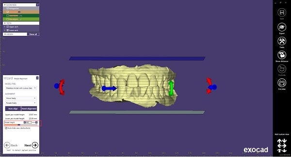 (1) Select “model type” & define the&nbsp; “model height”