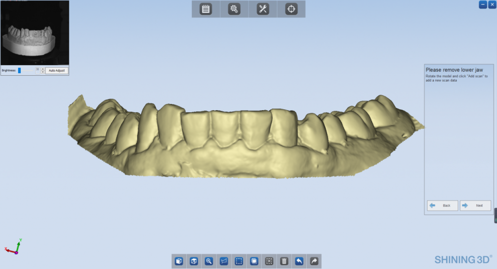 Data of the opposite jaw was real-time displayed on the computer