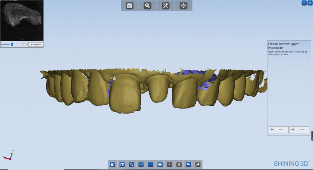 Captured Impression data