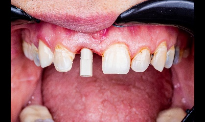 3-Jan-07-2026-09-03-12-5216-AM