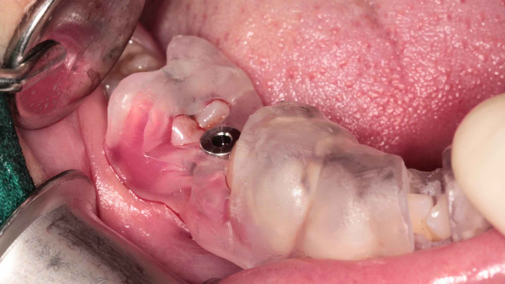 3-Jan-08-2026-04-09-10-6118-AM