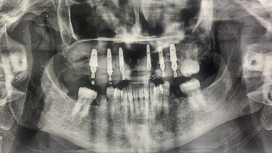 3-Jan-15-2026-02-56-39-4522-AM