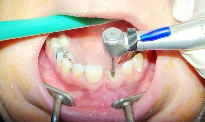 4-Jan-07-2026-08-54-57-9531-AM