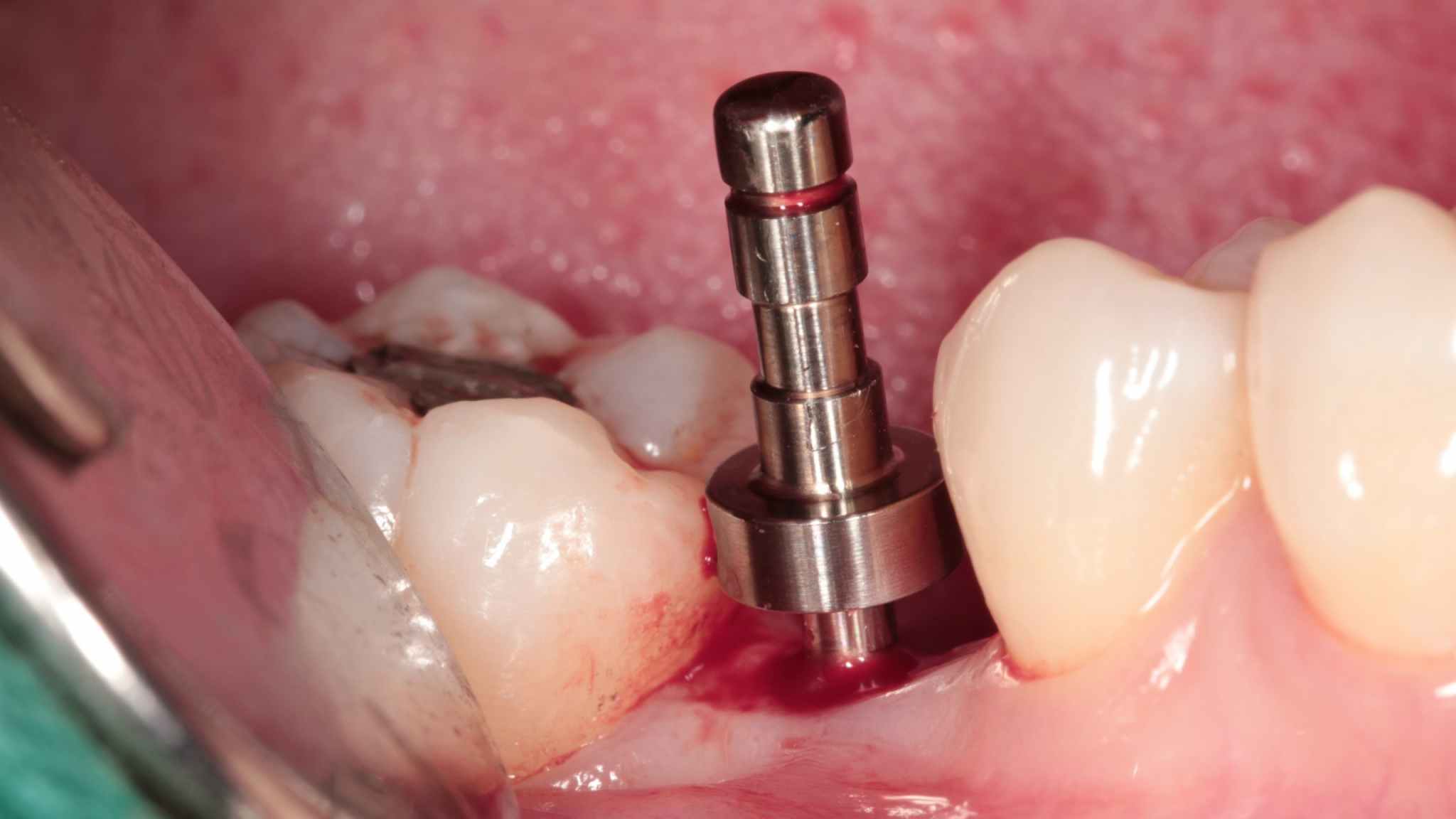 4-Jan-08-2026-04-09-20-2334-AM