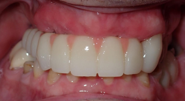 4-Jan-13-2026-03-50-17-1877-AM