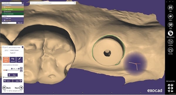 (5) Define emergence profile