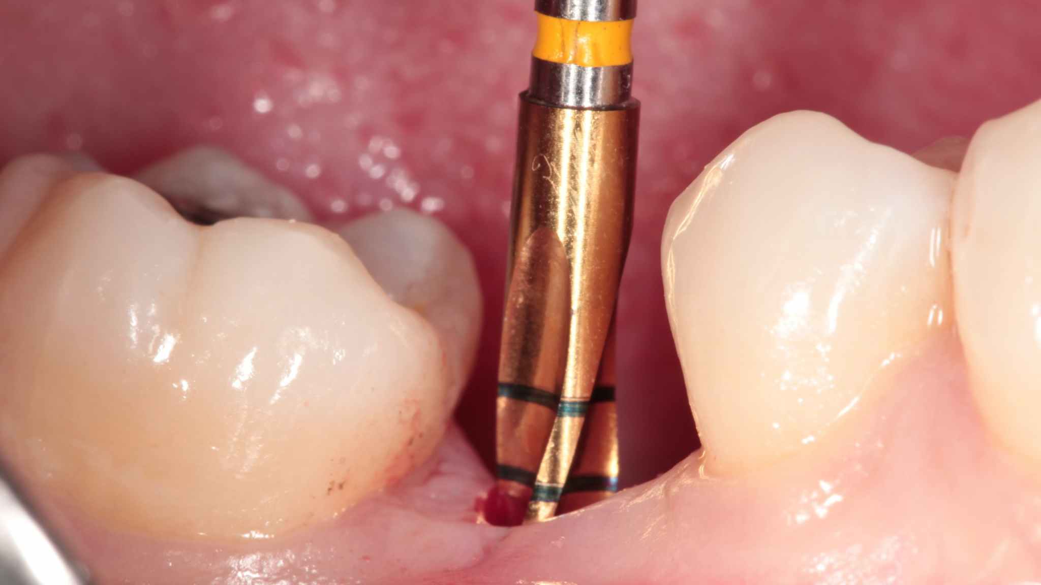 5-Jan-08-2026-04-10-08-7806-AM