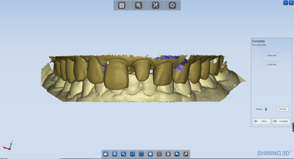 Aligned the upper and lower jaw models with bite wax.