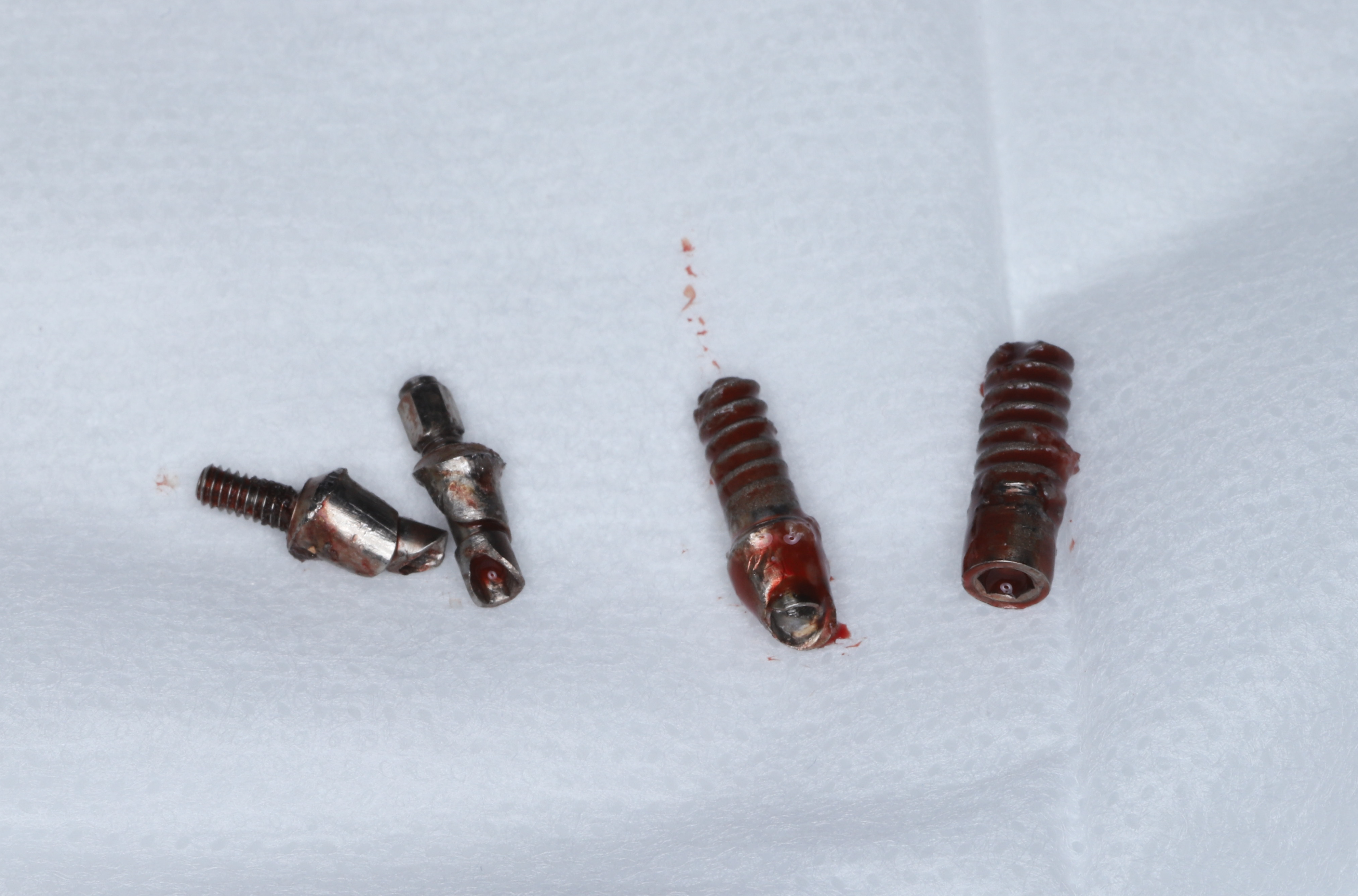 Removed dental implant components and fixtures after explantation