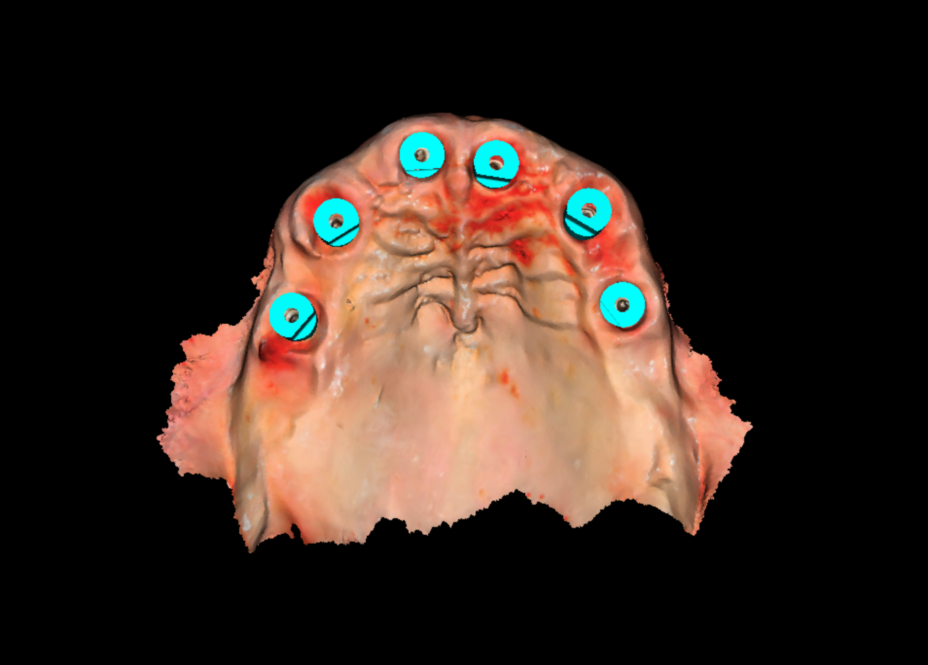 final teeth scan 3.png