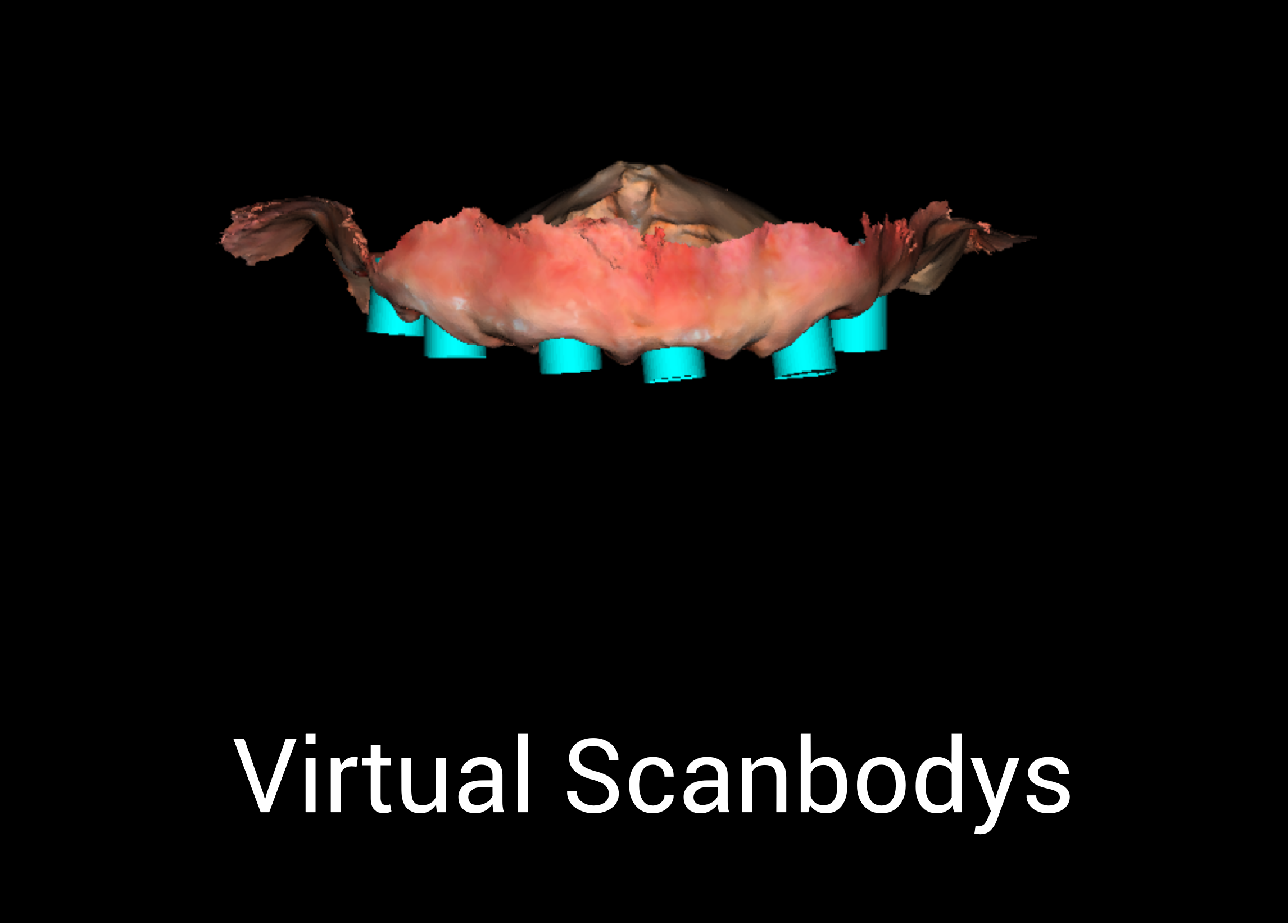 final teeth scan 6