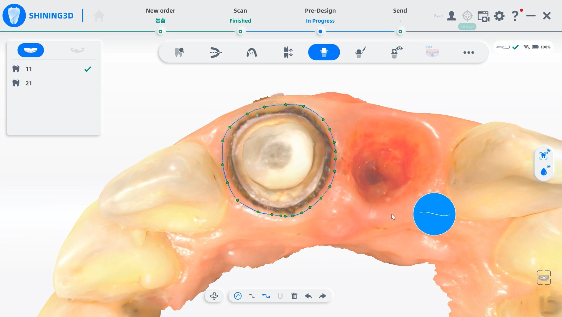 Margin Line Auto Extraction