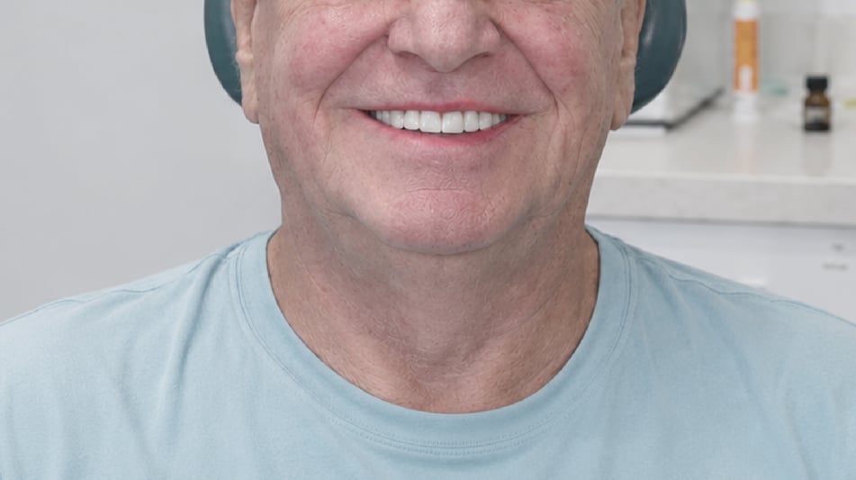 dental model 3d printer