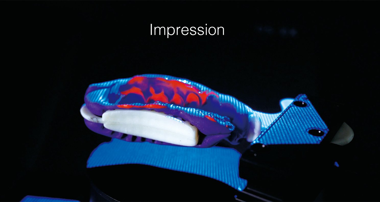 SHINING 3D DENTAL Impression