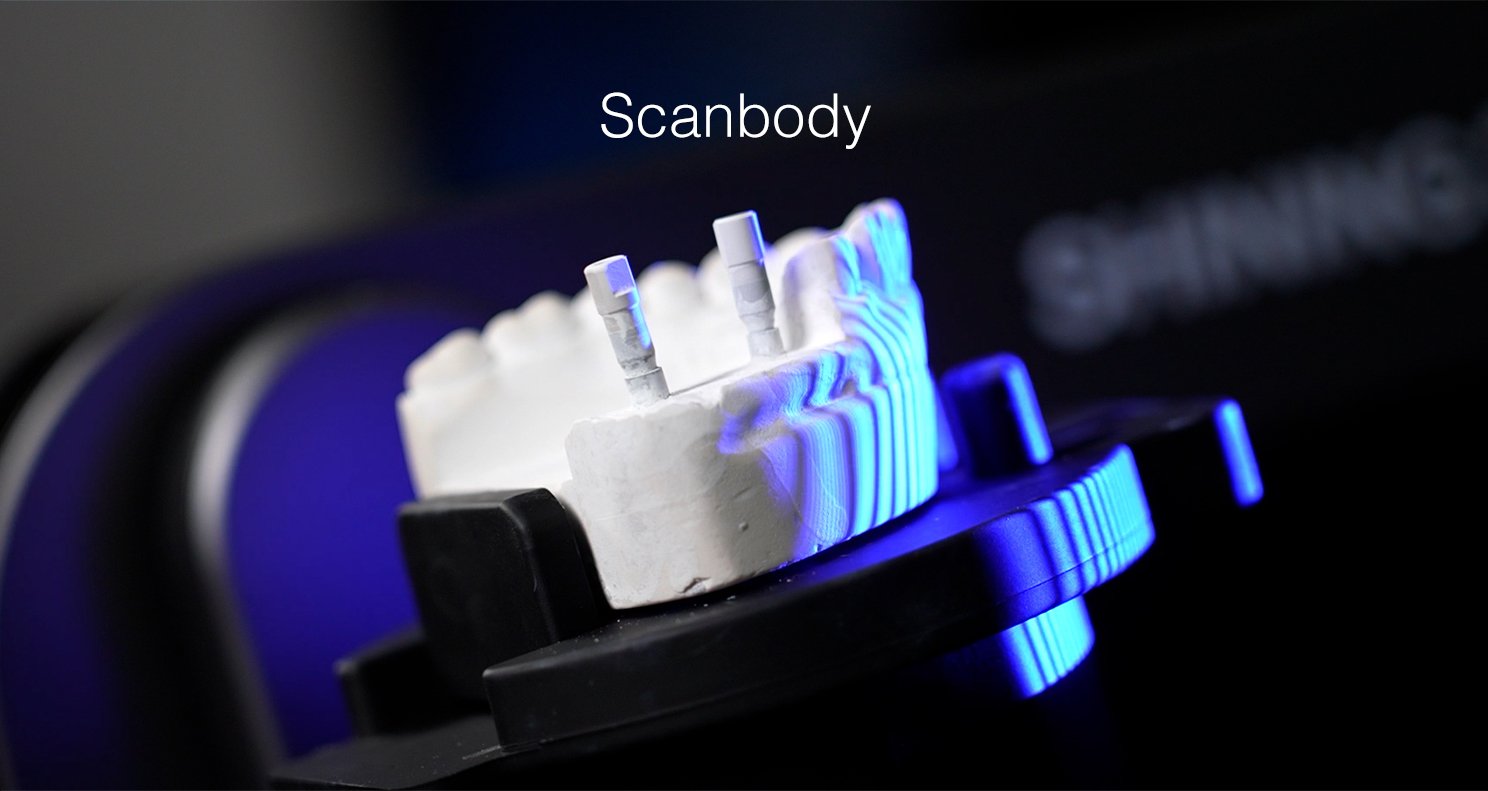 SHINING 3D DENTAL EPH Application