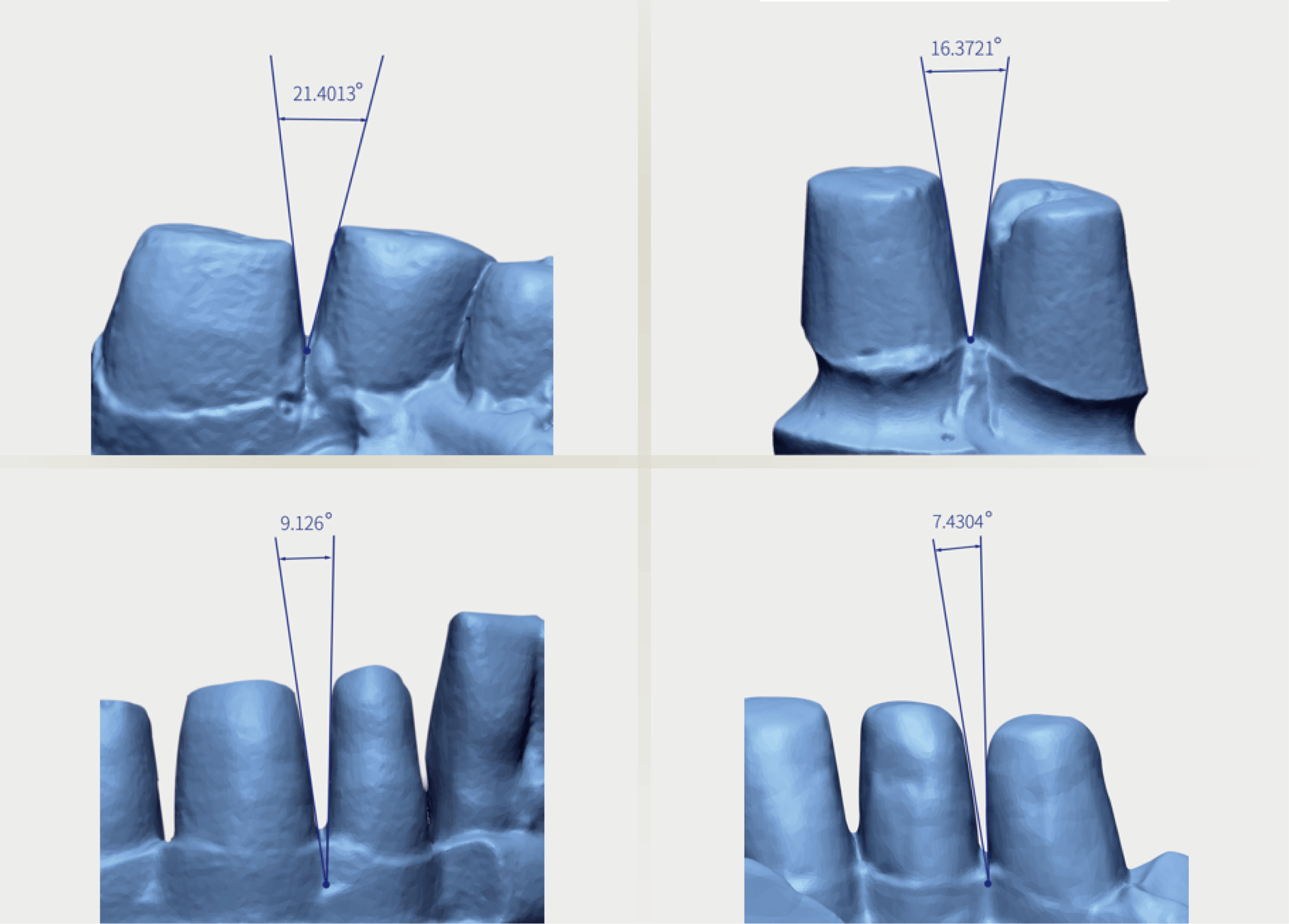  AutoScan-DS-EX Pro(C)_optimized non-separeted model scan