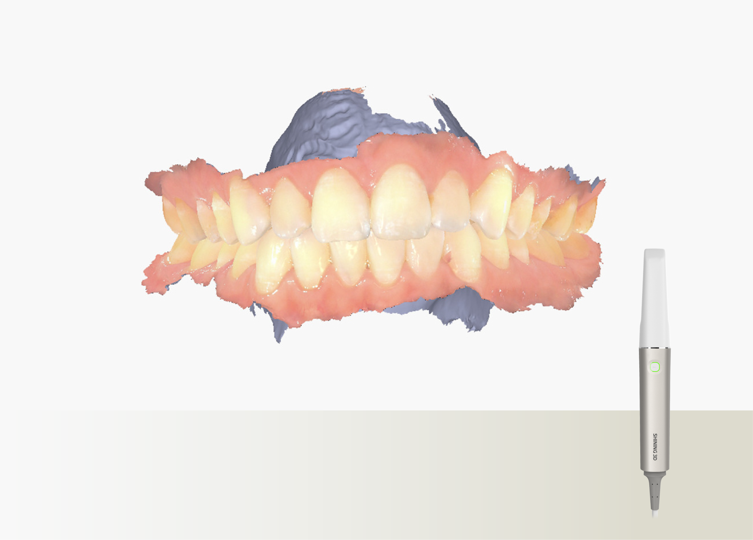 A premium intraoral scanner: the Shining 3D Aoralscan Elite