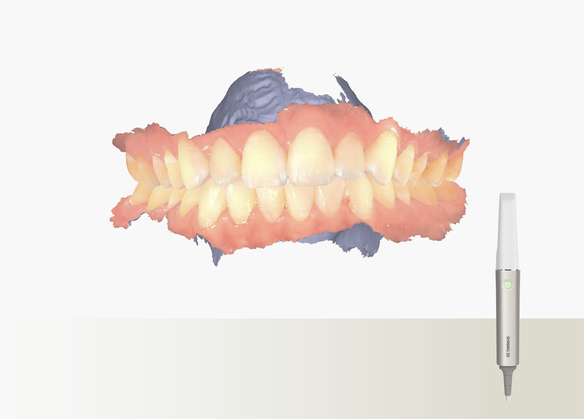 Intraoral scanner with photogrammetry