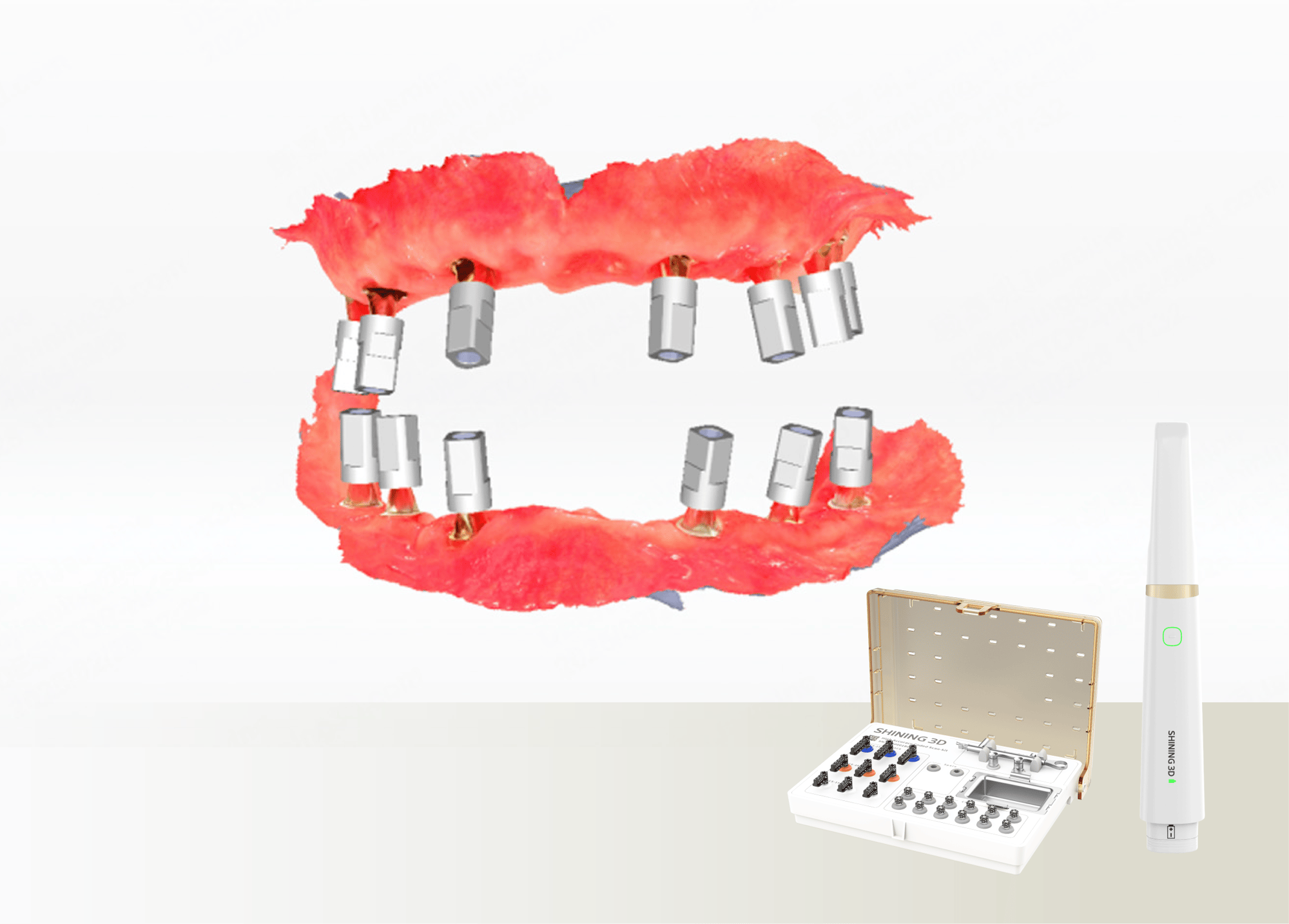 High accuracy intraoral scanner with Photogrammetry for All-on-X