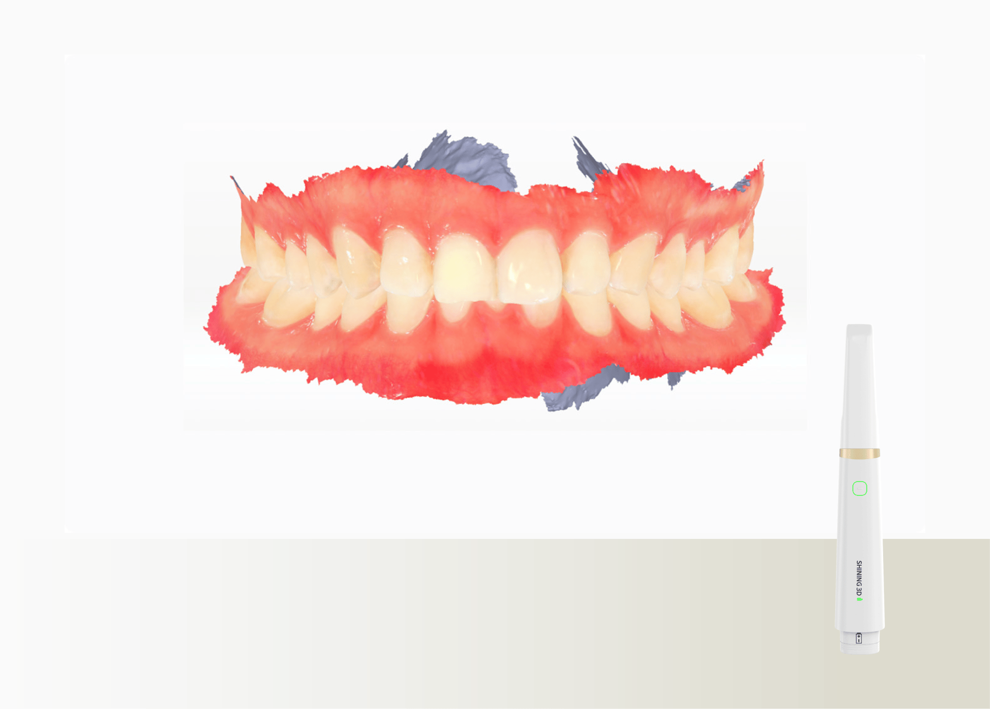 フォトグラメトリーによる口腔内スキャナー