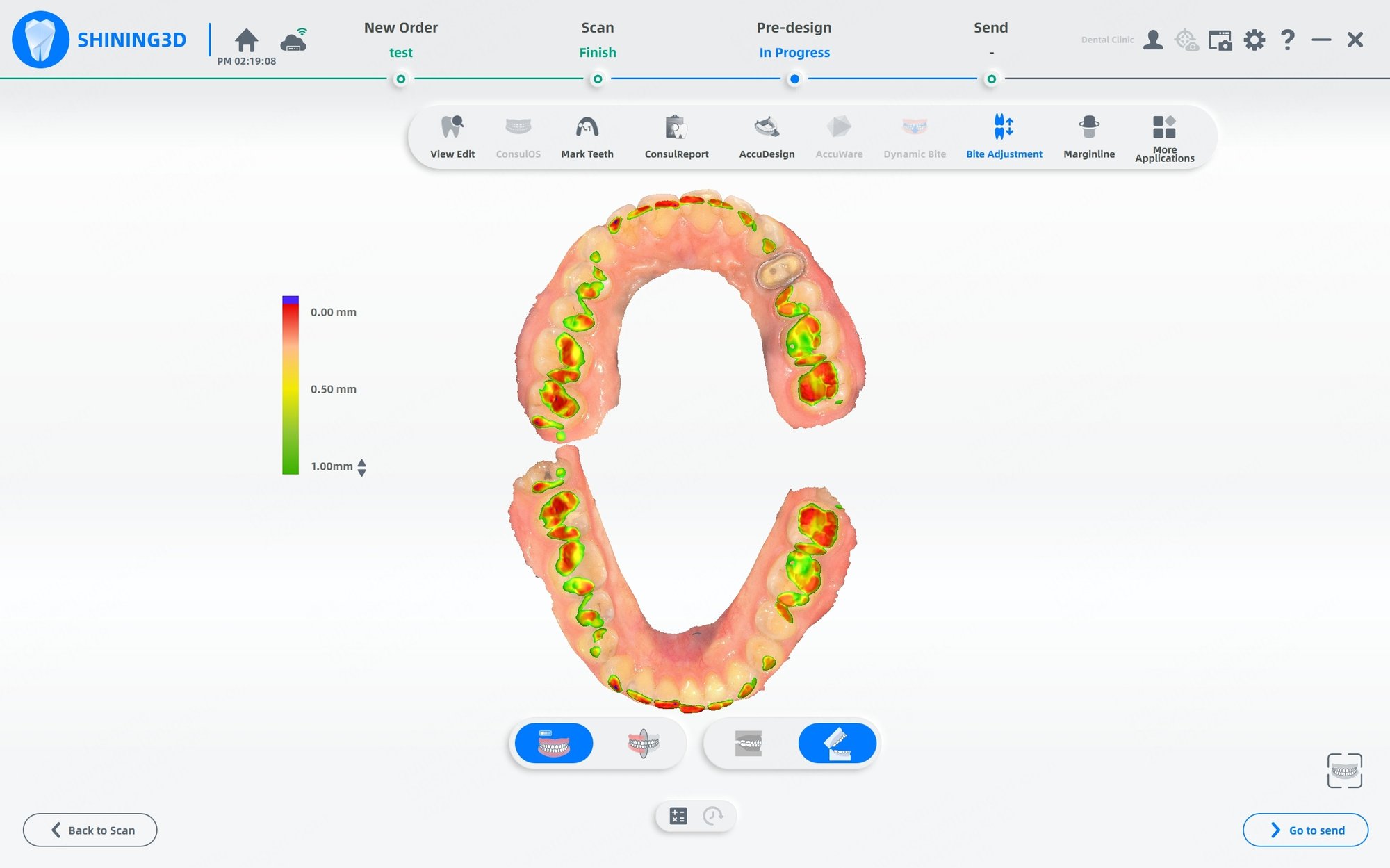 Aoralscan 3 intraoral scanner -Bite Check fuction