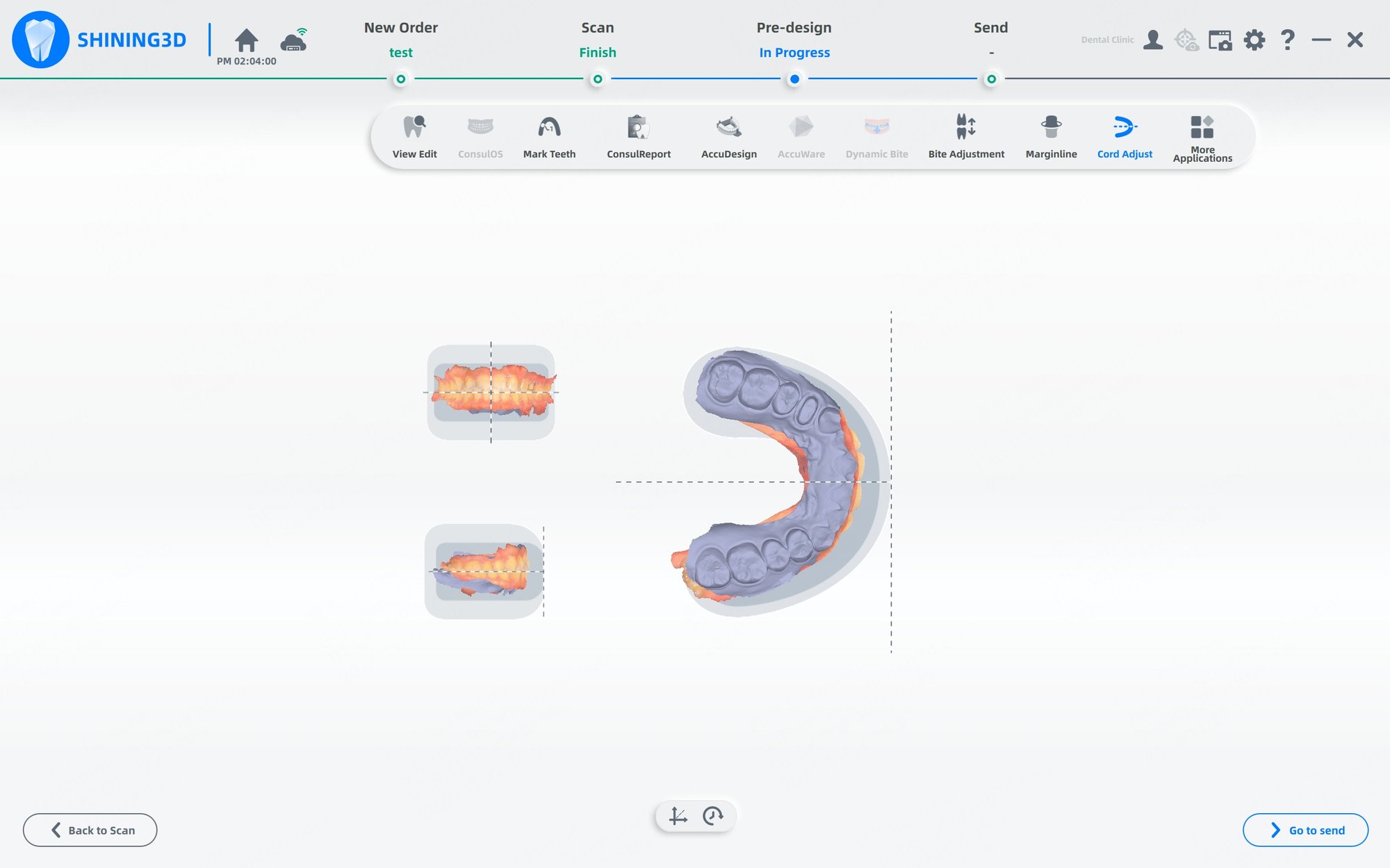 口腔内スキャナー Aoralscan 3 座標調整機能
