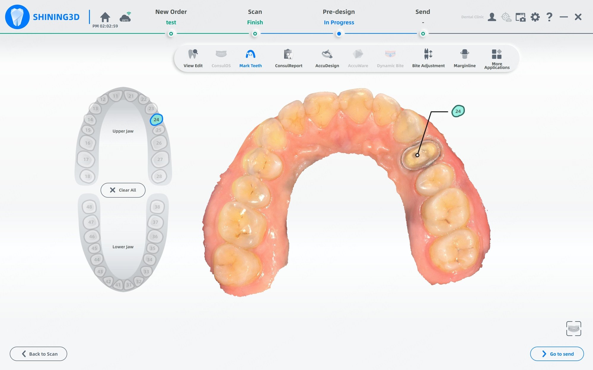 Aoralscan 3 intraoral scanner Tooth Marking function
