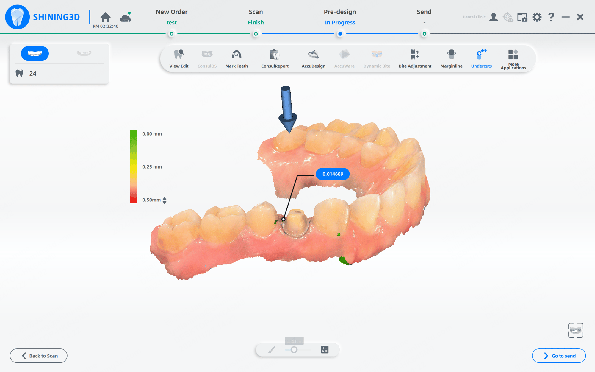 口腔内スキャナー Aoralscan 3 アンダーカットチェック機能