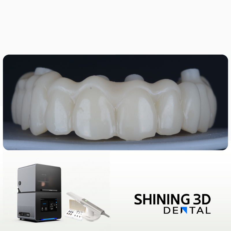 All-on-6 Upper Jaw Implant Rehabilitation with Early Loading in 72 Hours
