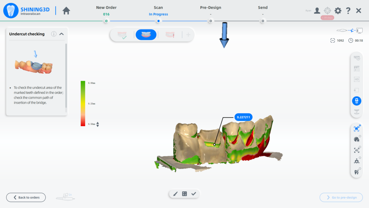 How to Use Margin Line Identity Function in SHINING 3D Aoralscan Software