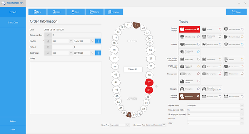 3D scanning the impression