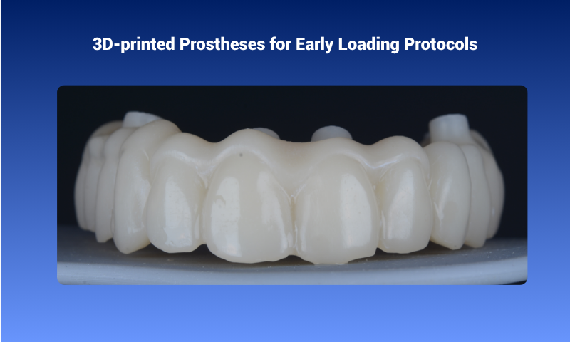 3D-printed prostheses for early loading protocols