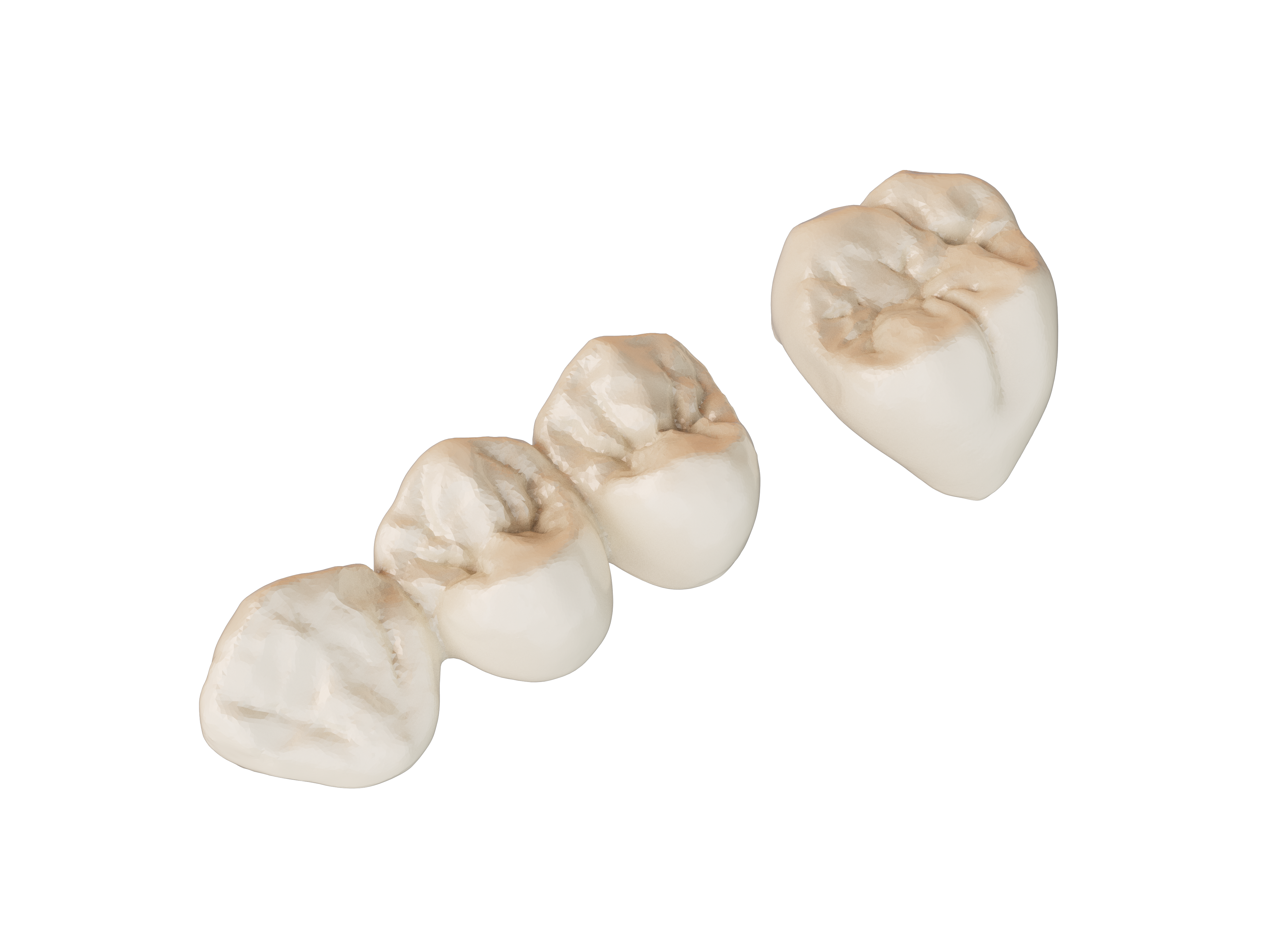  Temporary Crown&Bridge