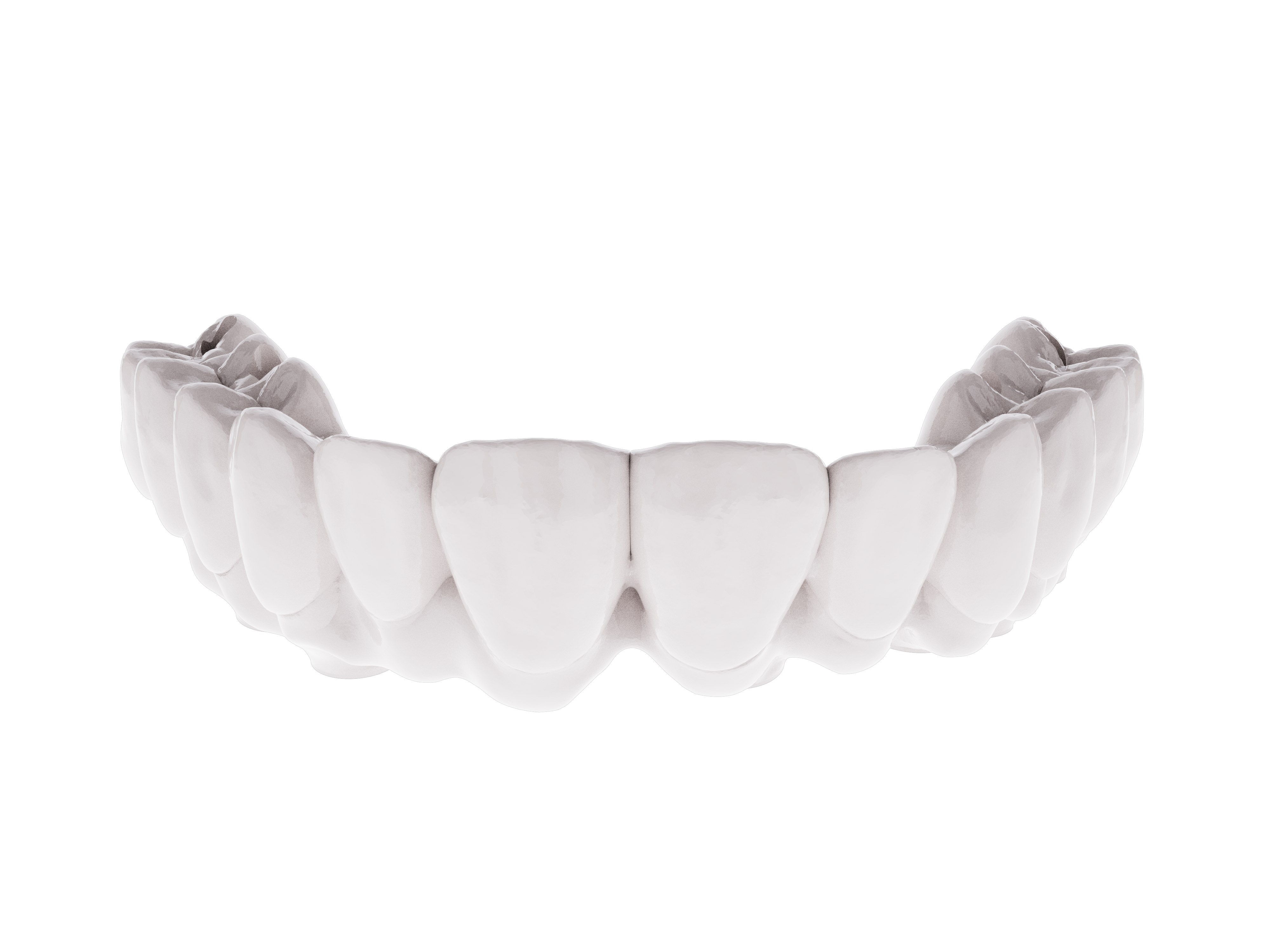 All on X Temporary Prosthesis