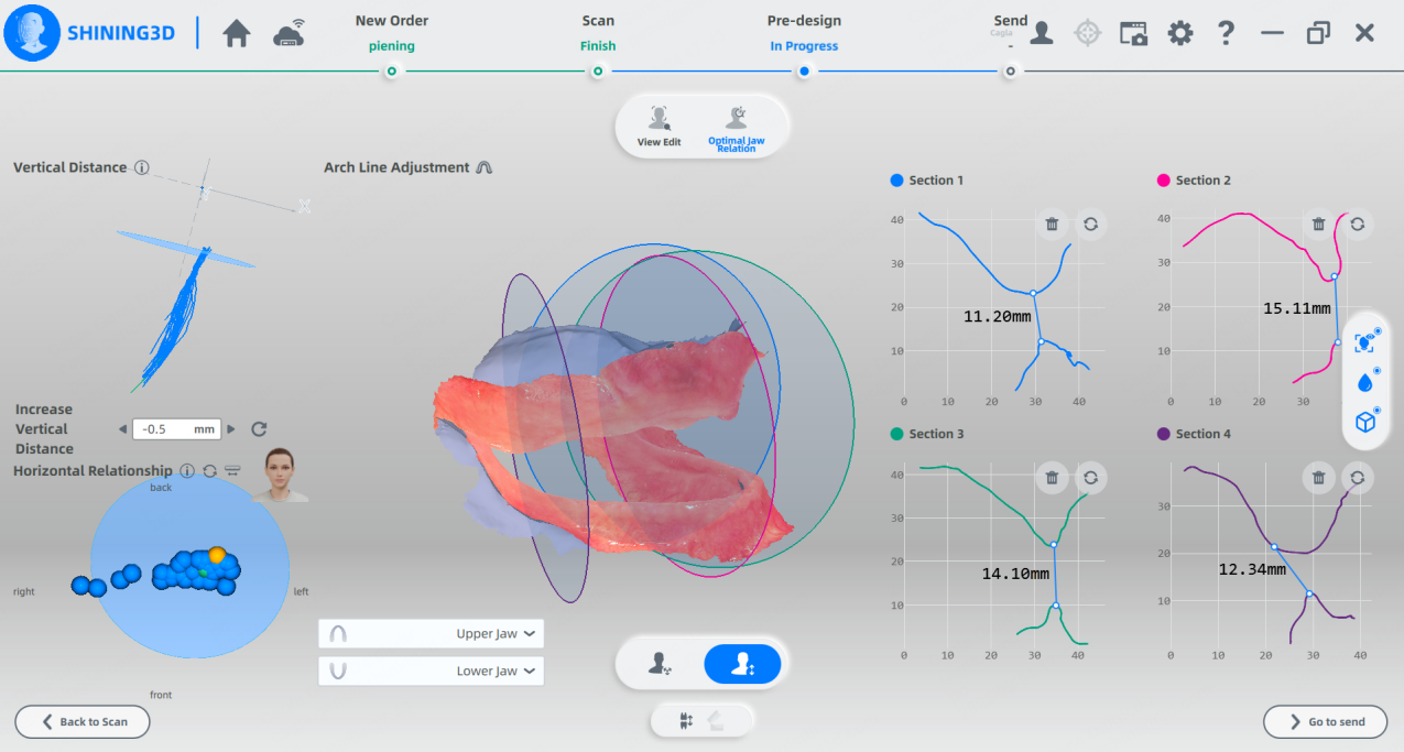 Analysis Results of Optimal Jaw Relation