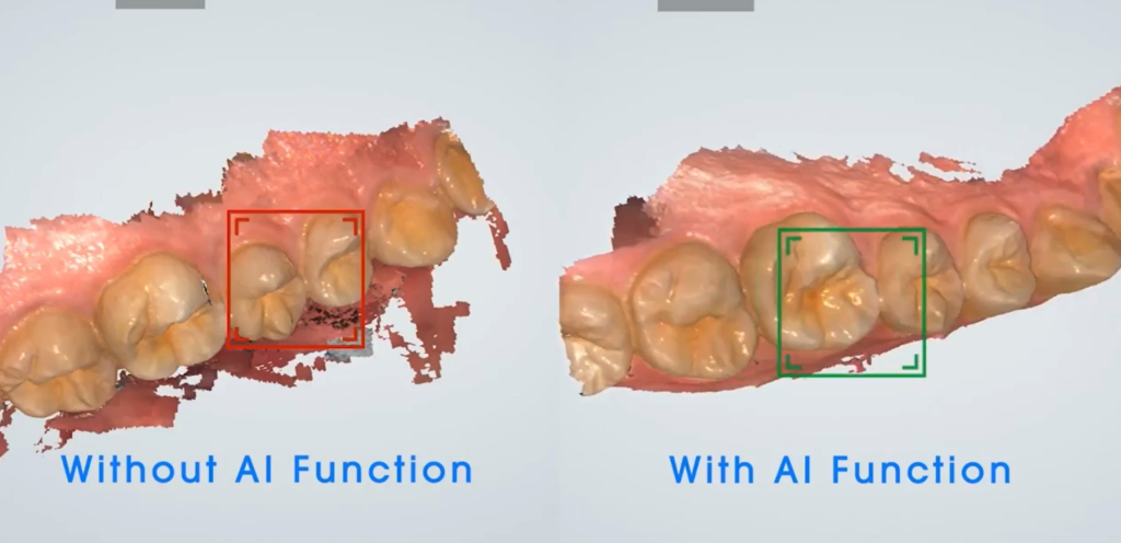 Aoralscan AI Function