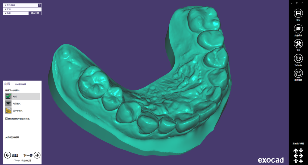 Design of surgical guide with GuideMia & model with Exocad