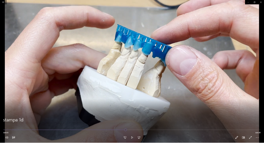 Digital Wax-up Bridge Application