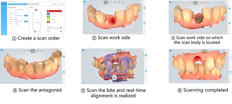 Intraoral-Scan