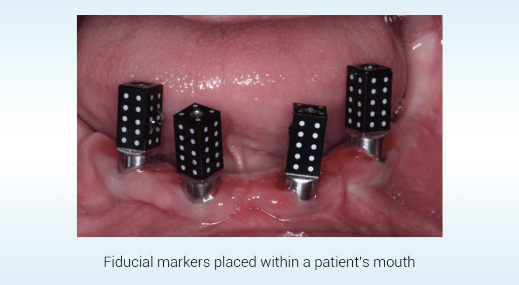 Photogrammetry vs IOS- Capturing Full Arches in the 3D Realm