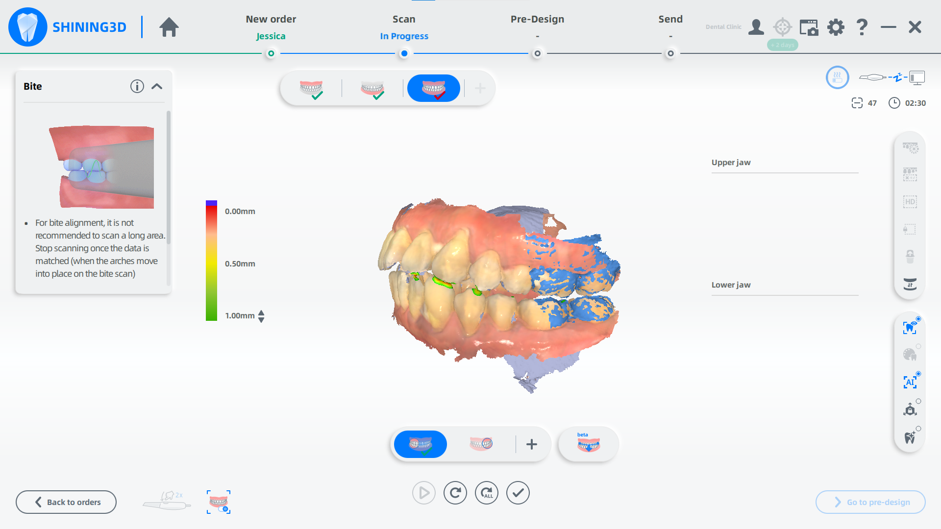 Scan Advice for Different Types of Occlusions