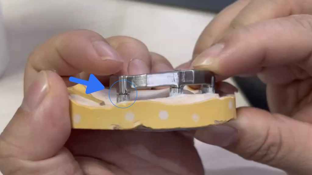 Traditional precision issue of passive fit