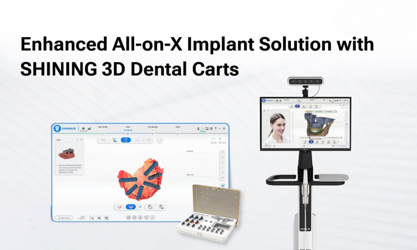 enhanced-all-on-x-implant-solution-with-shining-3d-dental-carts