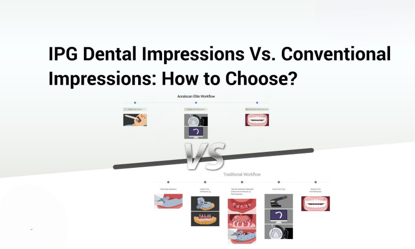 ipg-dental-impressions-vs-conventional-impressions